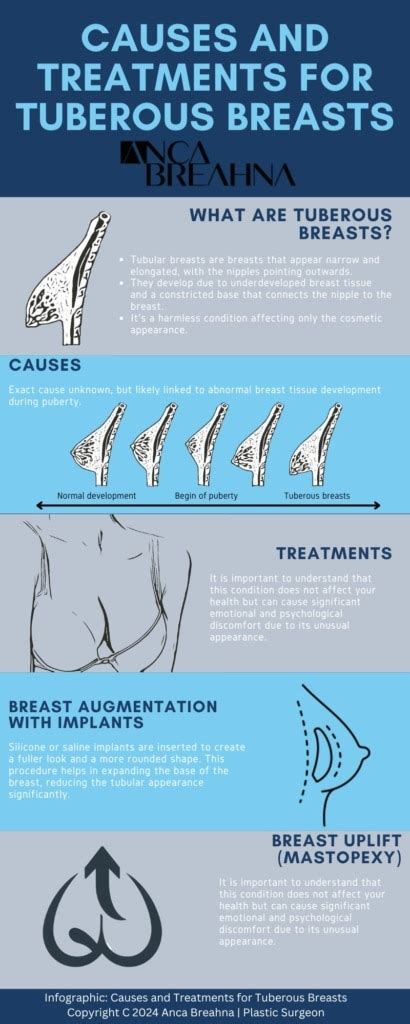 Tubular Breasts: Causes, Symptoms & Treatments